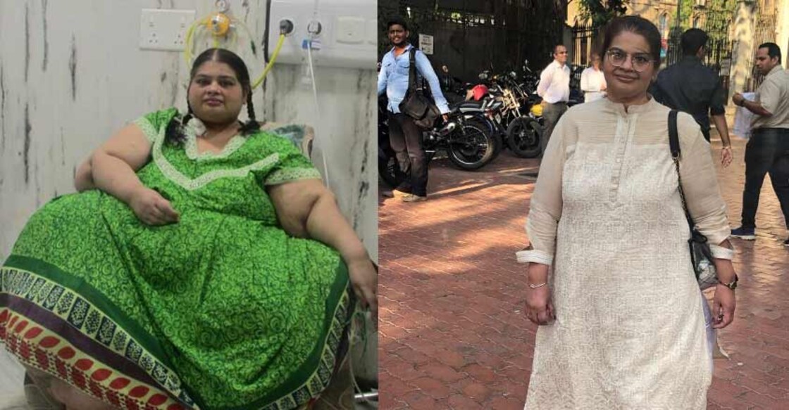 Asia's heaviest woman sheds 214 kgs in four years