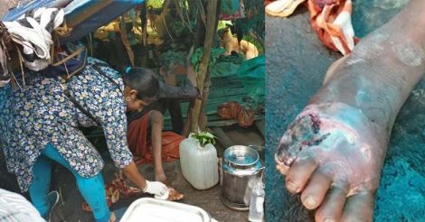 Intrepid lady doctor trundles across forest to rescue hostile tribal