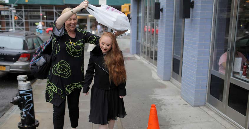 Model with Down's syndrome makes strides worldwide Model with Down's syndrome makes strides worldwide