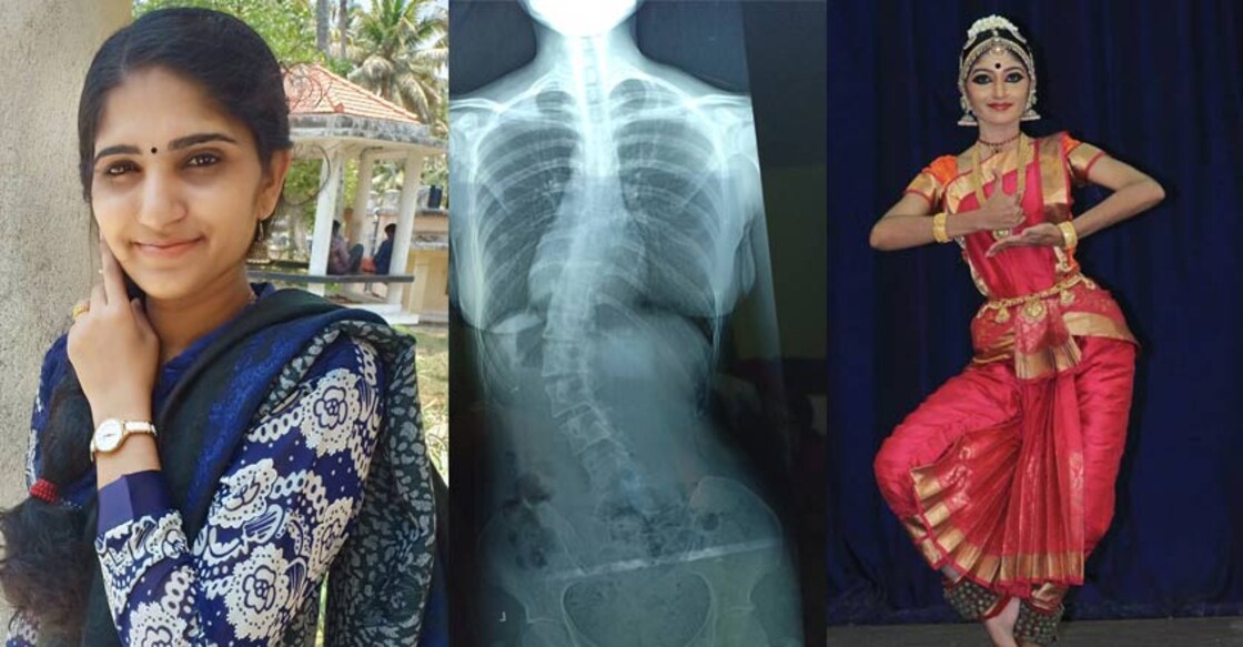 Bhavya, a gritty dancer who defeated a defect in her spine 
